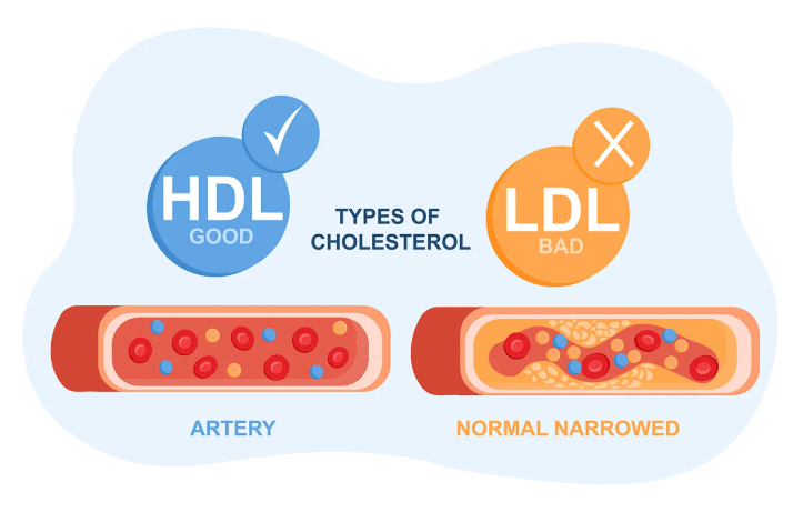 เปิดโปรแกรมออกกำลังกาย เพิ่ม HDL ต่อสู้คอเลสเตอรอลอันตราย ป้องกันโรคหัวใจ