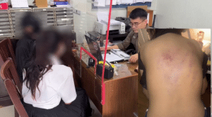 รับน้องโหด! นศ.ปี 1 ถูกรุ่นพี่ทำร้ายร่างกายจนฟกช้ำ – ถ่ายบัตรประชาชนข่มขู่ ขณะที่มหาวิทยาลัยยืนยันไม่ใช่กิจกรรมทางการ